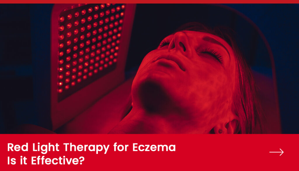 Red Light Therapy for Eczema